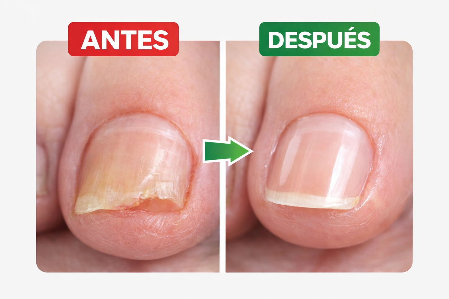 7 DAYS NAILS endurecedor de uñas Promocion 2x1