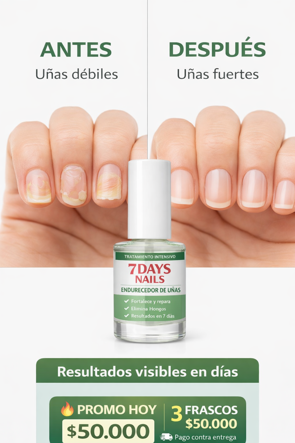 7 DAYS NAILS endurecedor de uñas · 3 unidades $50.000 | Tratamiento para uñas débiles