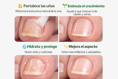 7 DAYS NAILS endurecedor de uñas Promocion 2x1